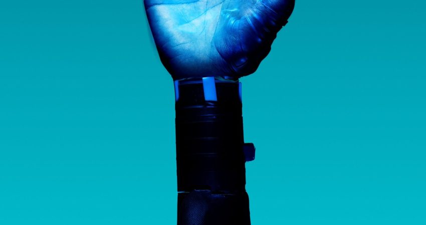 alt="Free Prosthetic Arm on Blue Background Stock Photo"